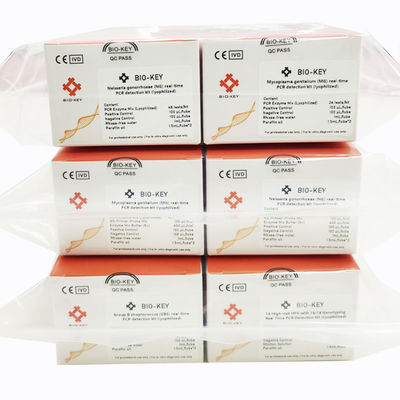 Epstein Barr Virus EBV Real Time PCR Detection Kit Lyophilized 96tests/Kit